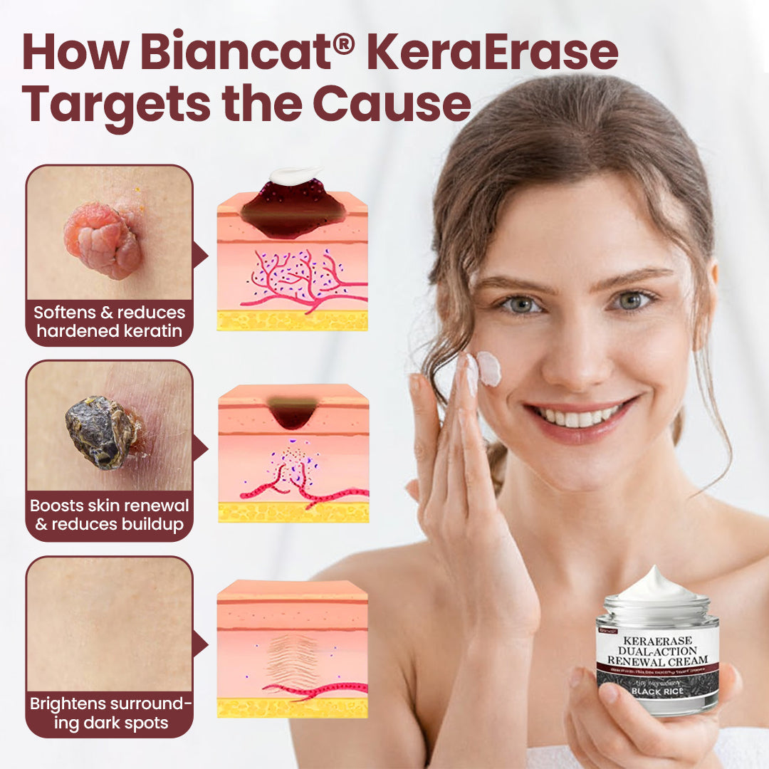 KeraErase Dual-Action Renewal Cream